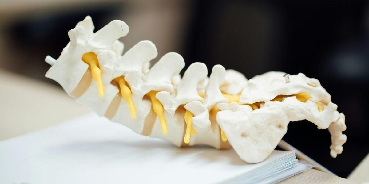 You Don't Have to Have Spinal Surgery. What Charlotte Patients Should Know Before the Operating Room